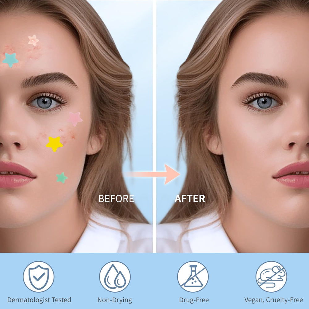 QUSTERE pimple patches 14mm size provides strong adhesion for bigger blemishes