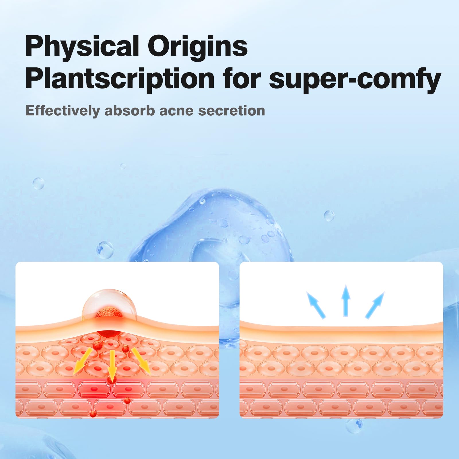 QUSTERE pimple patches open-pack shows portability and freshness