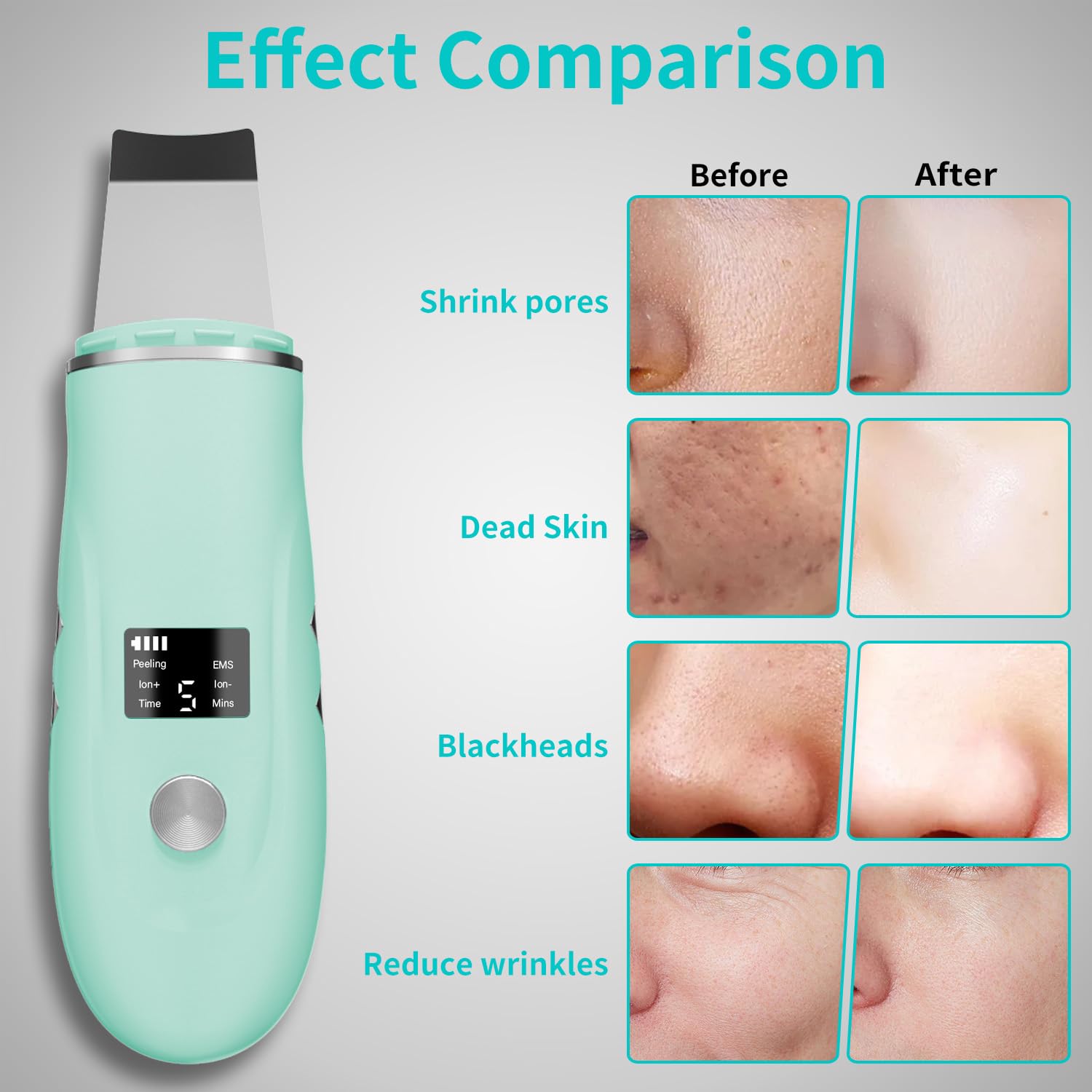QYCSL Face Scrubber enhances cream absorption for skincare routines.