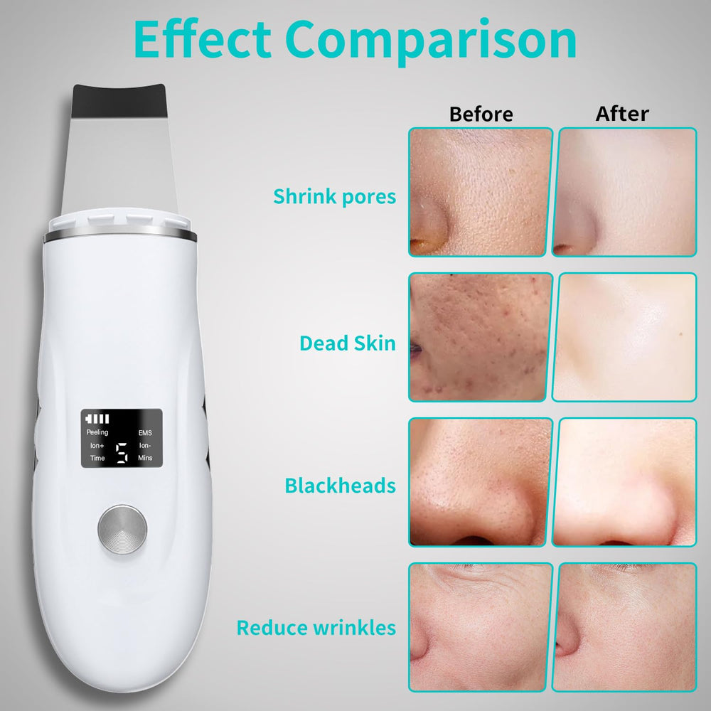 QYCSL face scrubber spatula 3D curve eases tricky contours