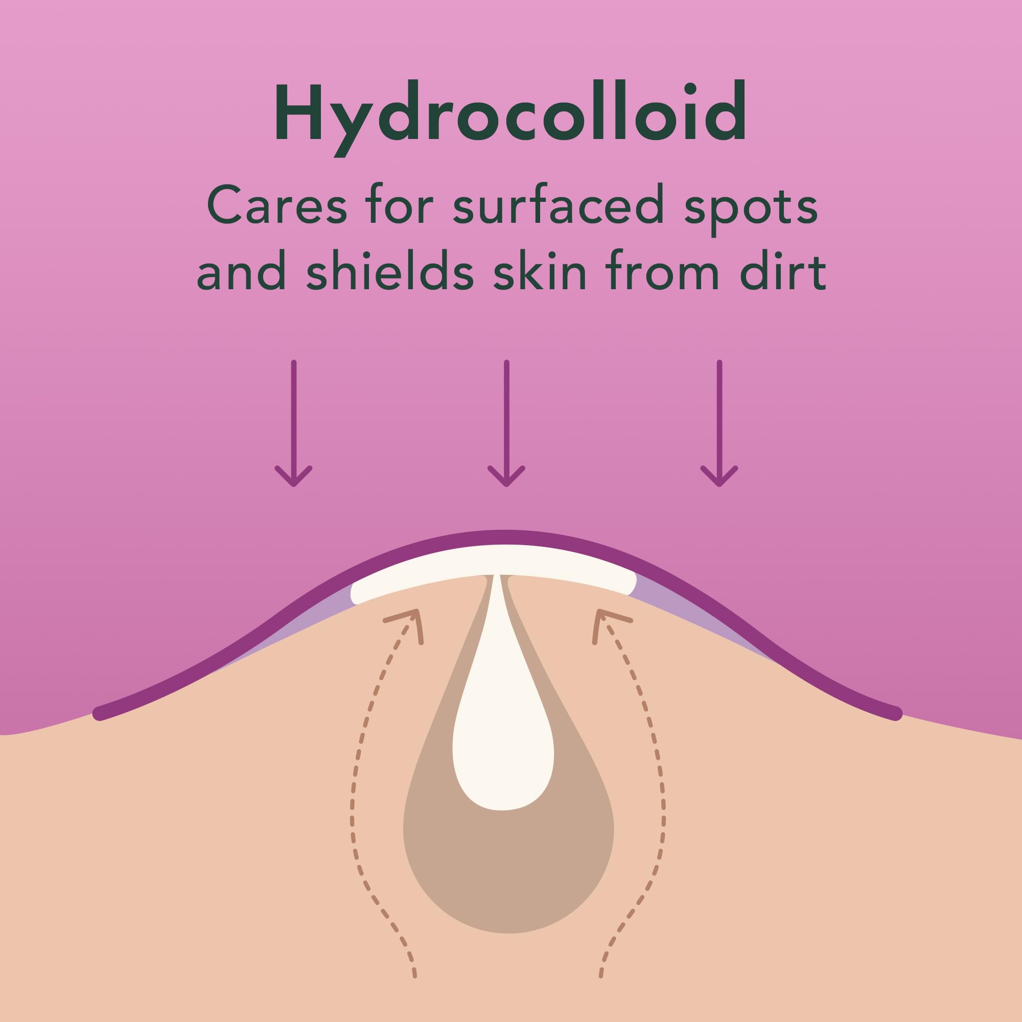 Rael pimple patches 12mm close-up demonstrates strongest adhesion for bigger spots