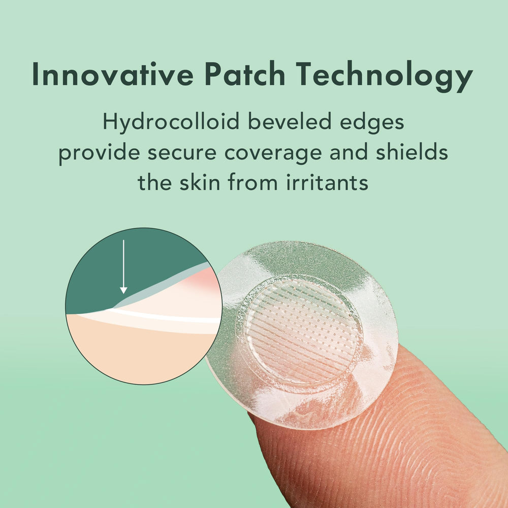 Rael Pimple Patches adhesive application shown on skin suggests secure wear for early-stage blemishes