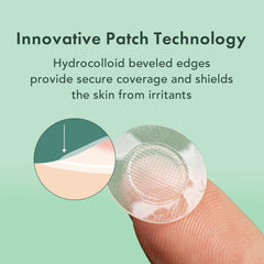 Rael Pimple Patches adhesive application shown on skin suggests secure wear for early-stage blemishes