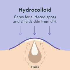 Rael pimple patches on chin illustrate a larger contour patch for tough spots.