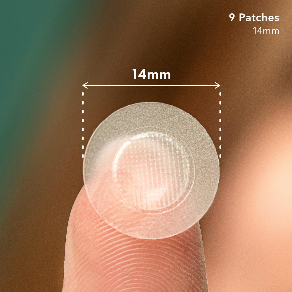 Rael pimple patches applied on skin for early-stage blemish coverage.