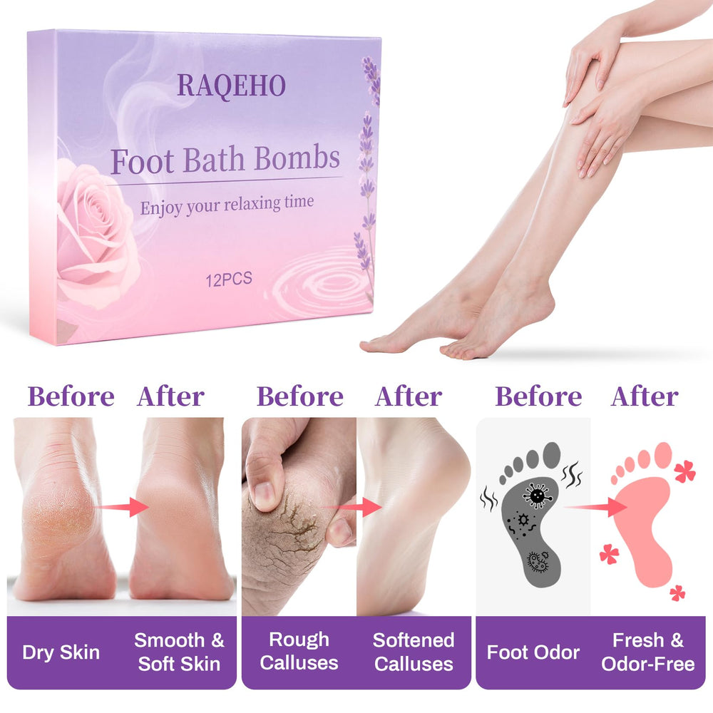 RAQEHO cocoa butter and shea butter moisturize deeply for dry feet.