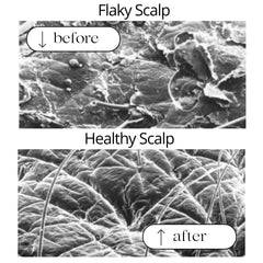 RAUSCH Coltsfoot shampoo ingredients natural extracts on list.