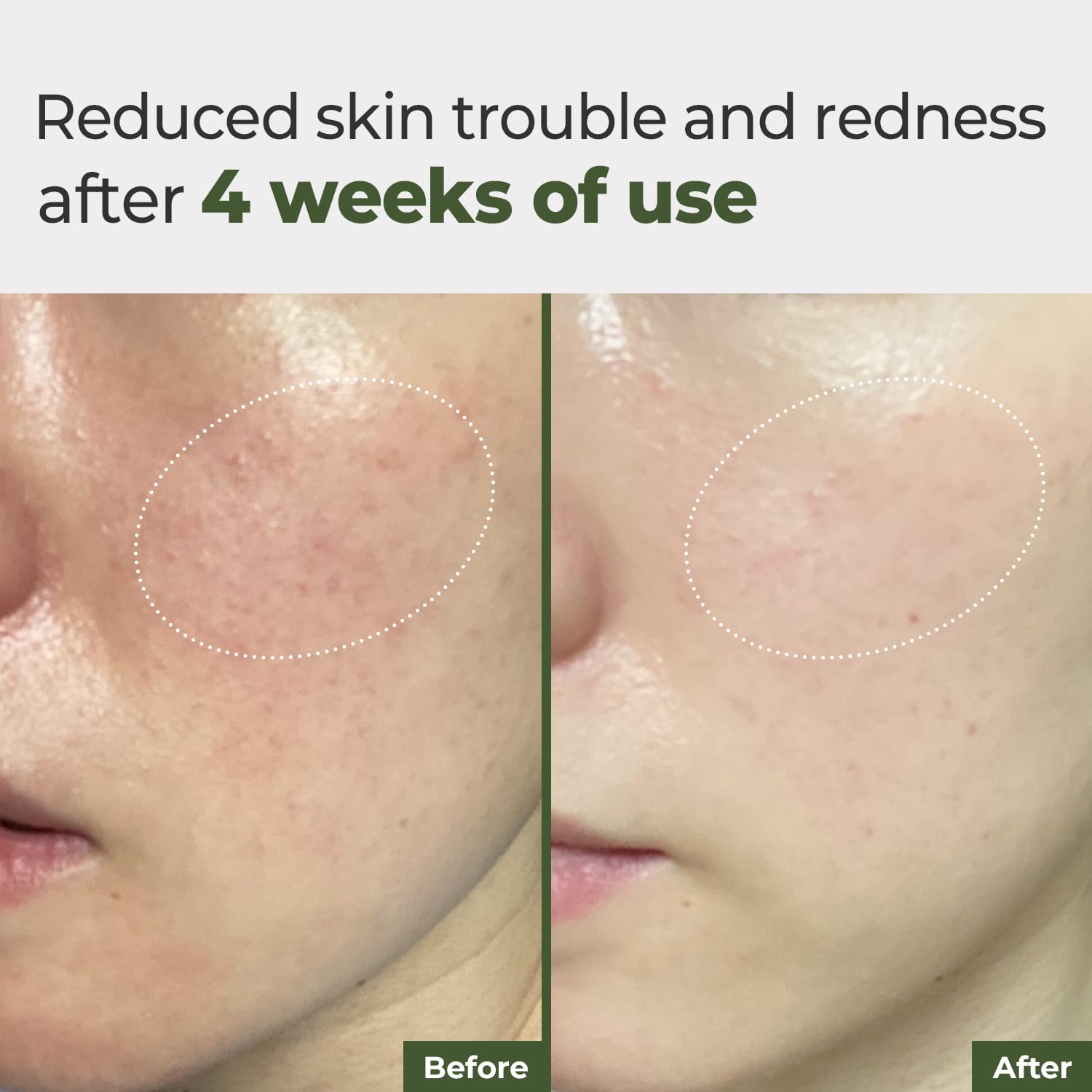 Rbfy Daily Ampoule Pad Chamomile and Houttuynia shot—gentle redness relief.