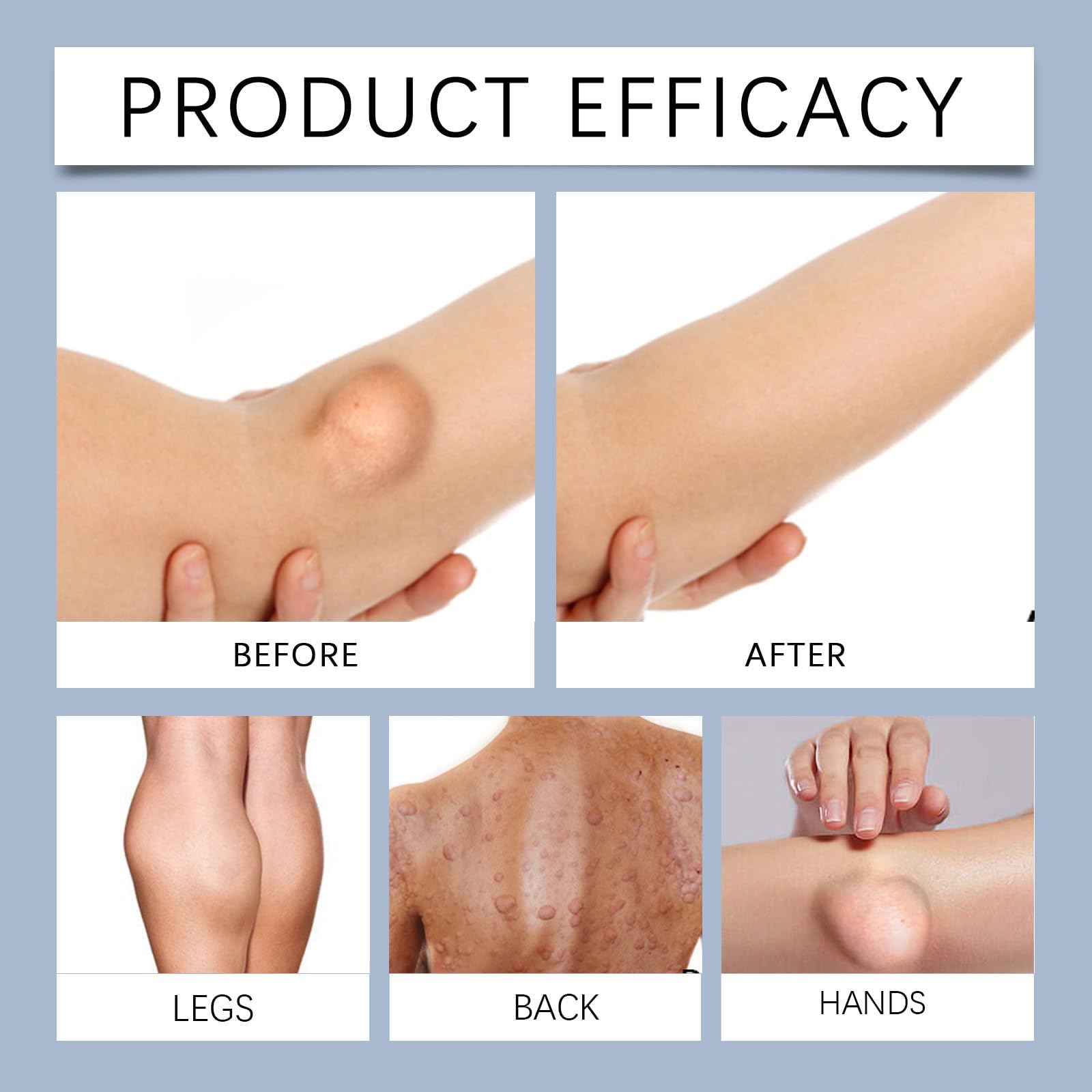 RCSCBC Formula suitable for different skin types with mild, non-irritating notes