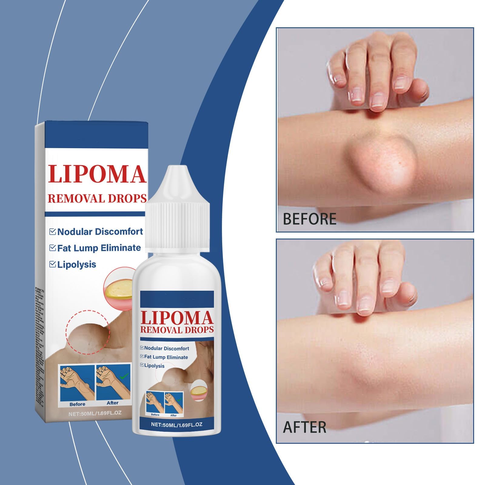 RCSCBC Herbal Lipoma Removal Drops closeup texture highlights natural herbs