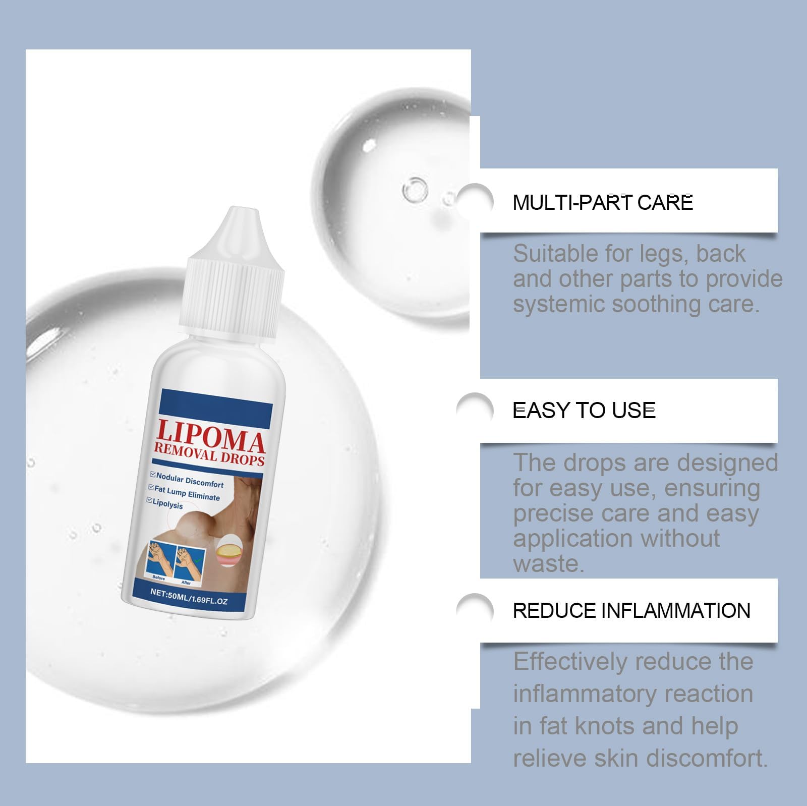 RCSCBC Lipoma Removal Cream jar application demonstrates easy skincare routine