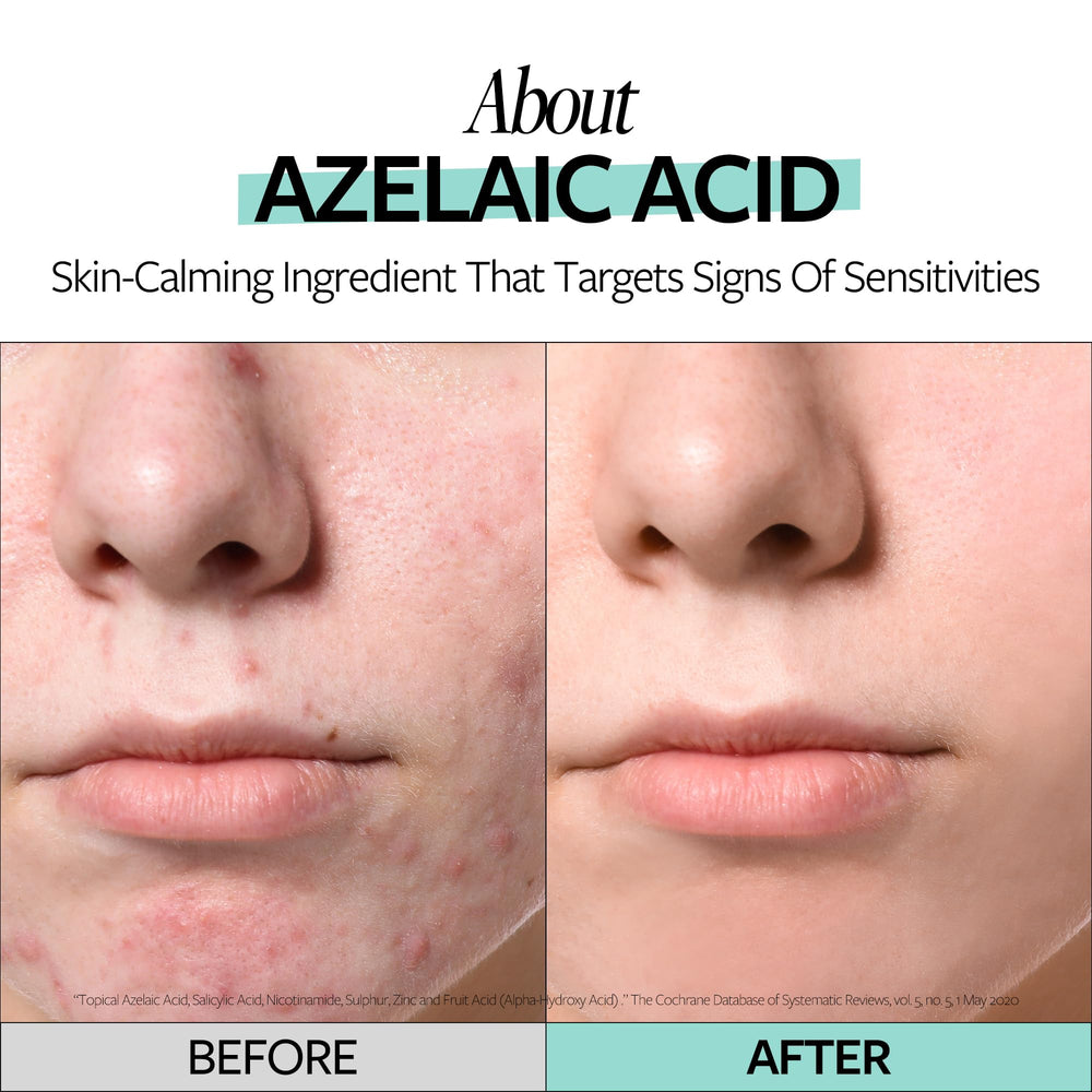 RE:CIPE Azelaic Acid 10% ampoule serum swatch demonstrating quick absorption