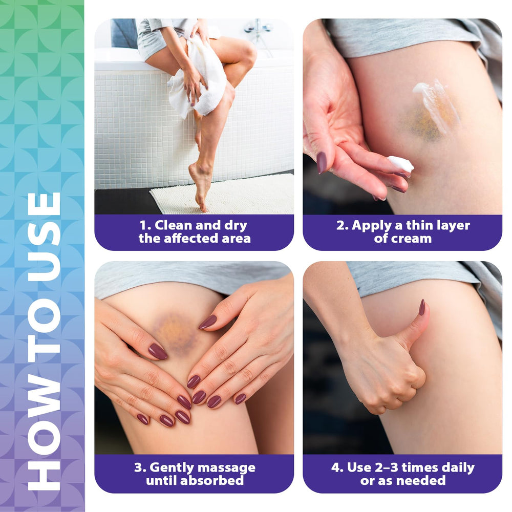 Recuren Plus Arnica Bruise Cream arm and leg area shows versatile use