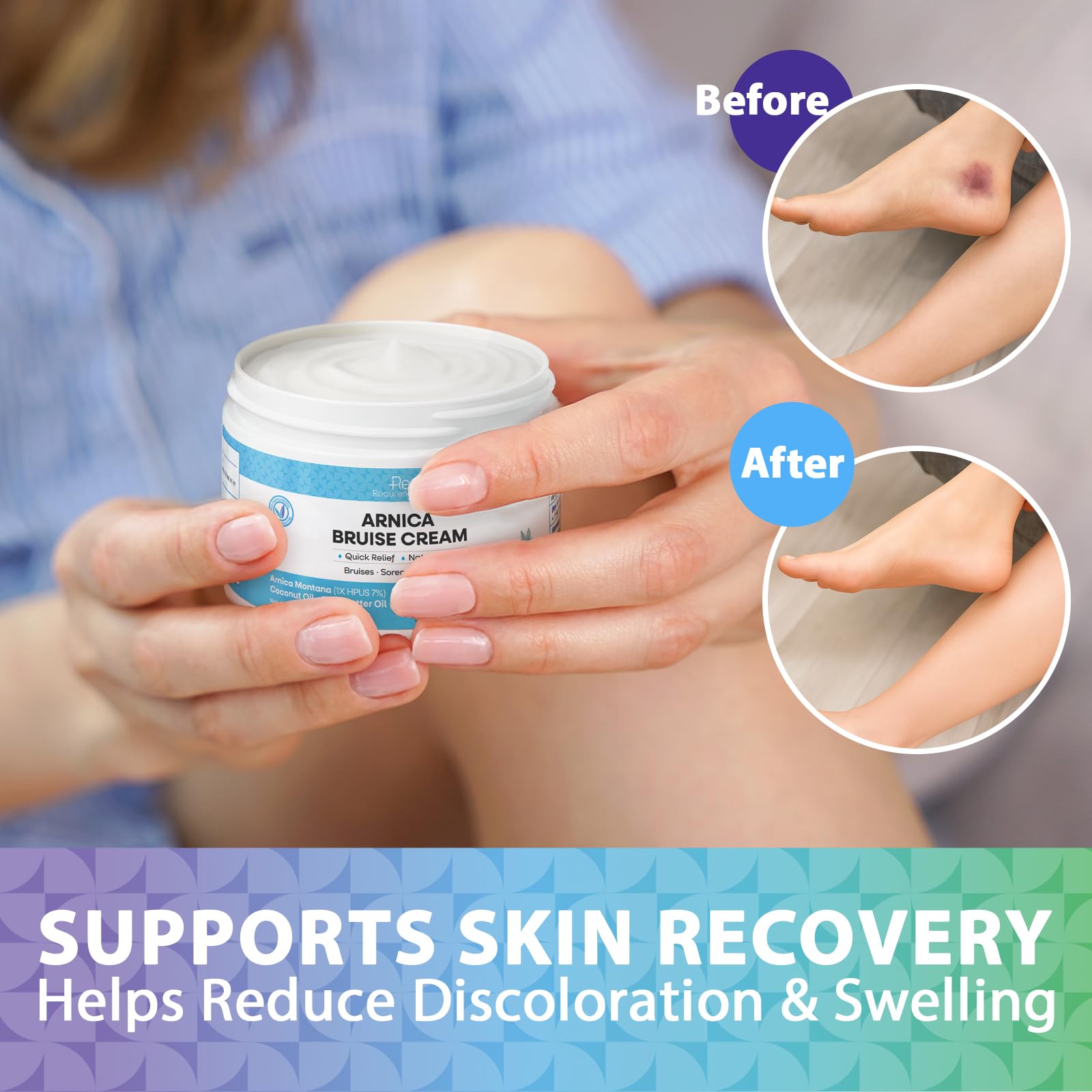 Recuren Plus Arnica Bruise Cream tube detail suggests convenient daily use for minor bumps