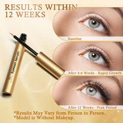 Recuren Plus natural nourishment with aloe ferox and green tea supports healthier lash appearance.
