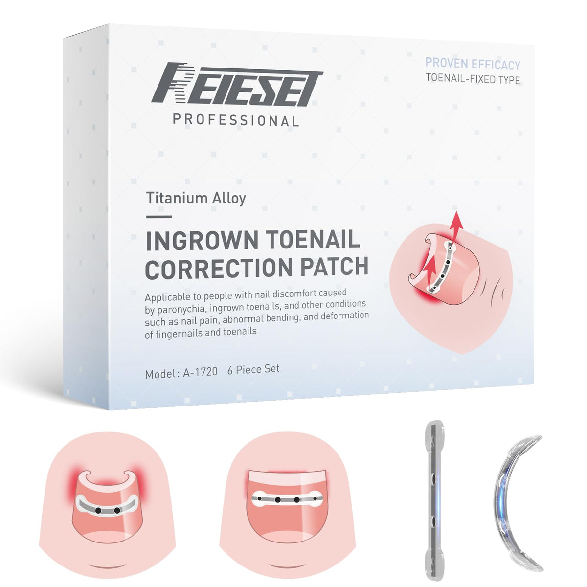 Reieset titanium alloy patch on toenail offering curved-nail correction for daily comfort.
