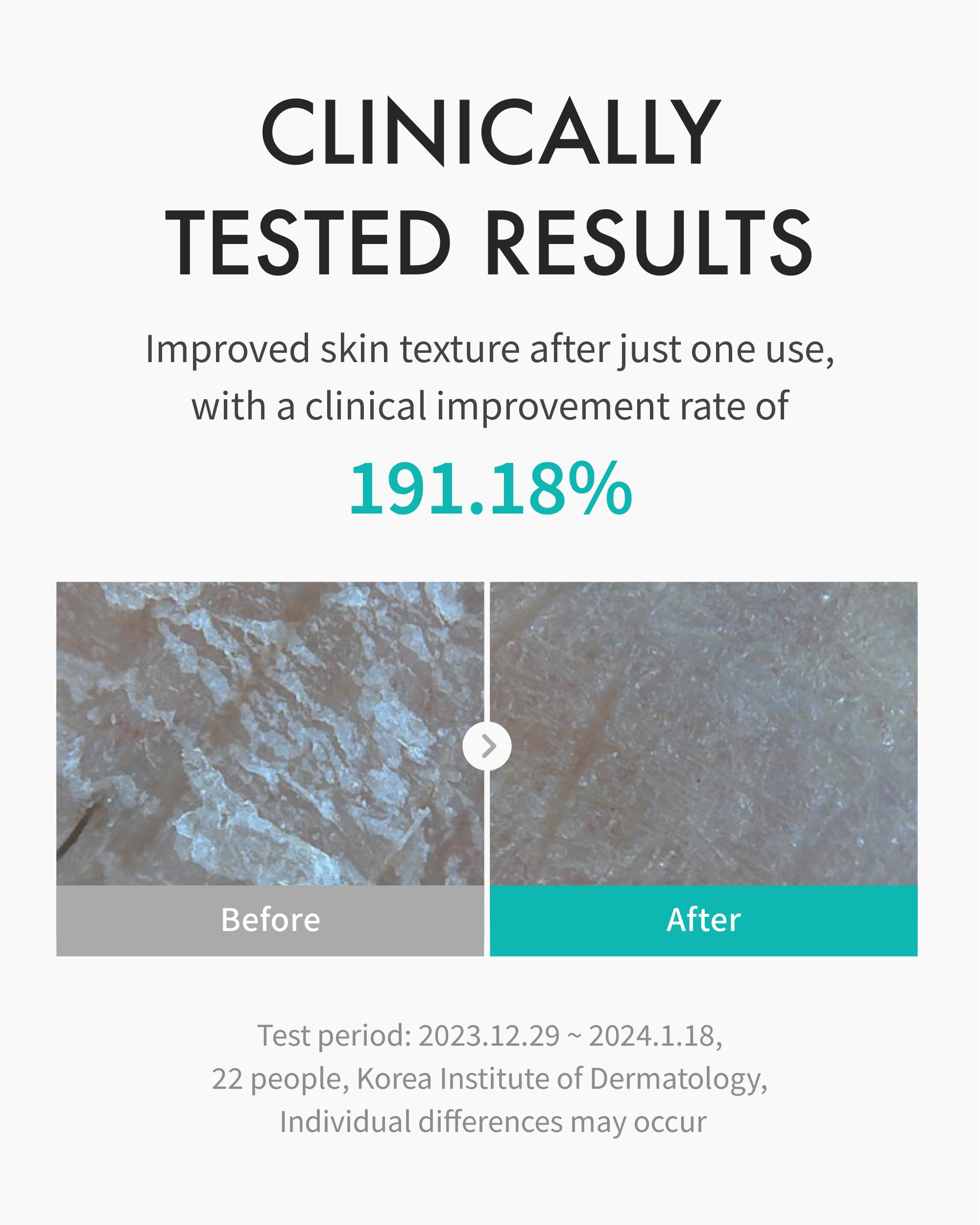 REJURAN Ceramide-rich formula illustration—barrier repair visualization