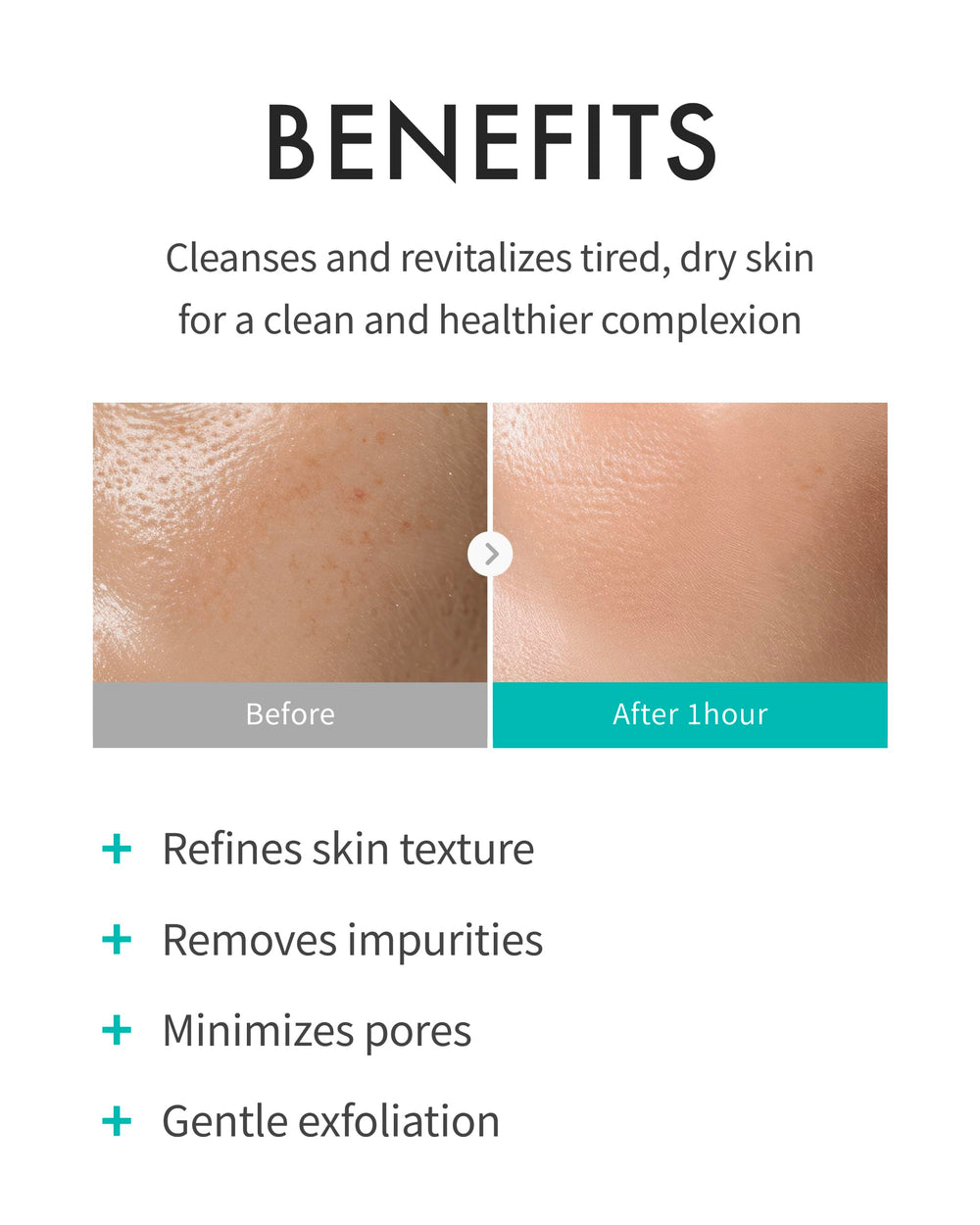 REJURAN Refining Foam Cleanser texture closeup showcasing creamy hydration after cleansing