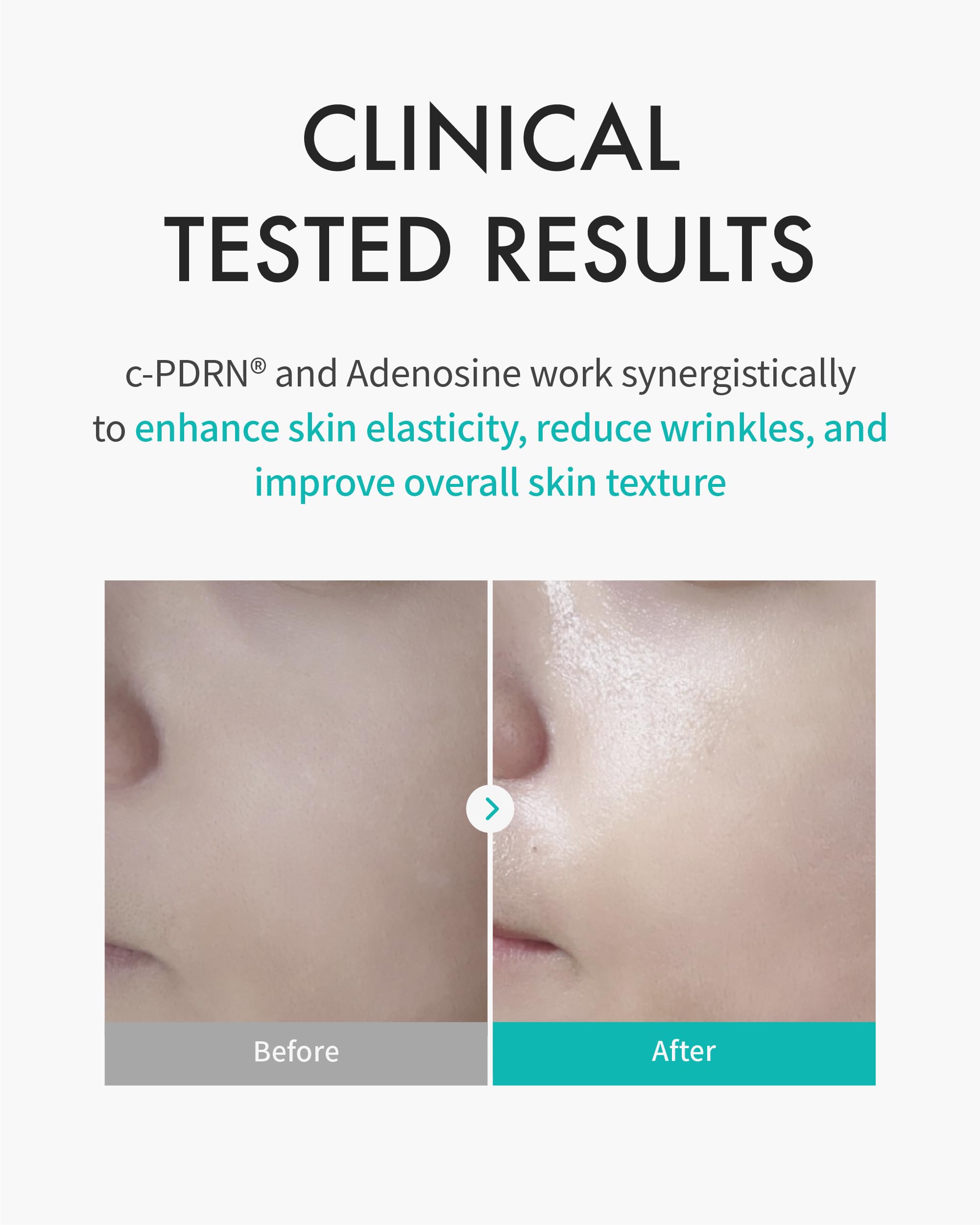 REJURAN Turnover Mask ultra-hydrating essence delivers dewy, nourished skin.
