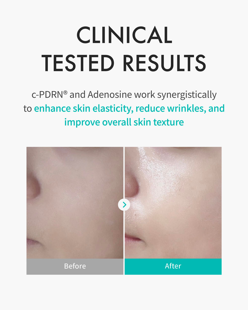 REJURAN Turnover Mask ultra-hydrating essence delivers dewy, nourished skin.