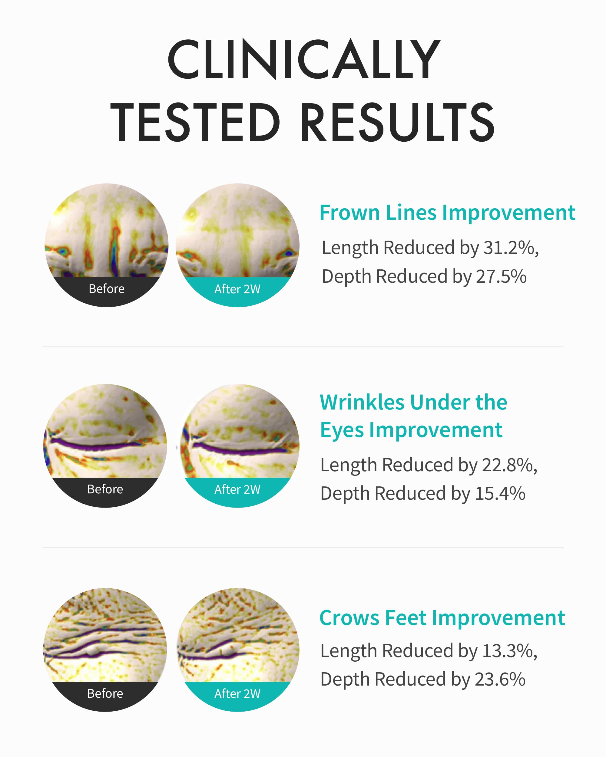 REJURAN Intensive Eye Cream featuring peptides to support elasticity around the eye.