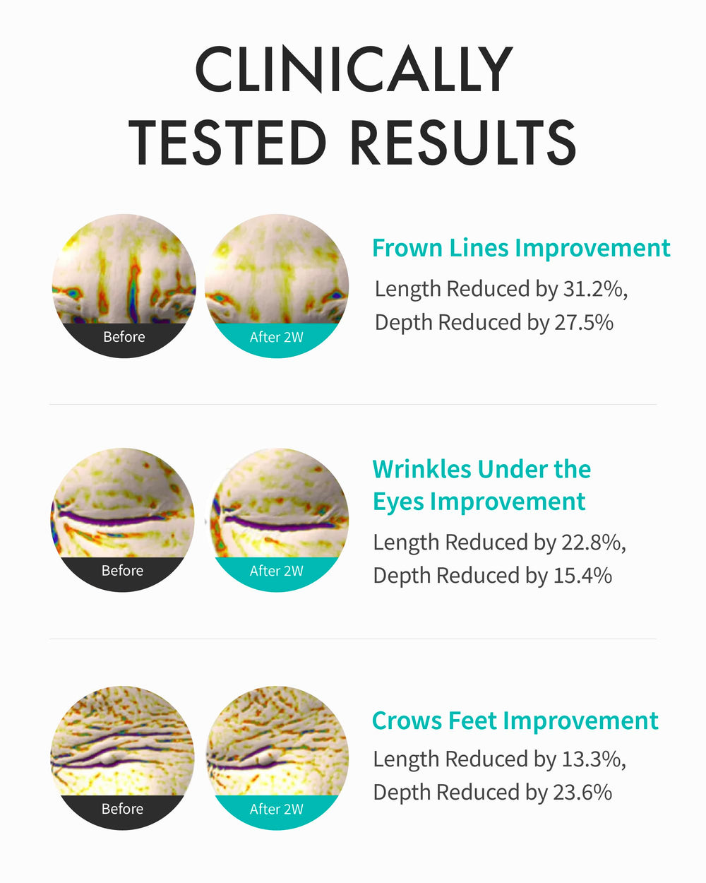 REJURAN Intensive Eye Cream featuring peptides to support elasticity around the eye.
