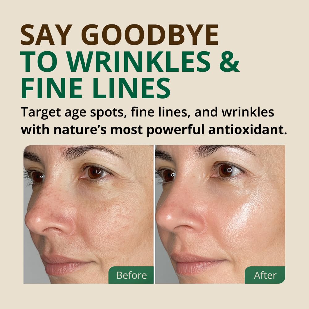 RejuveNaturals Vitamin E Oil on skin—soothing hydration for a refreshed look.