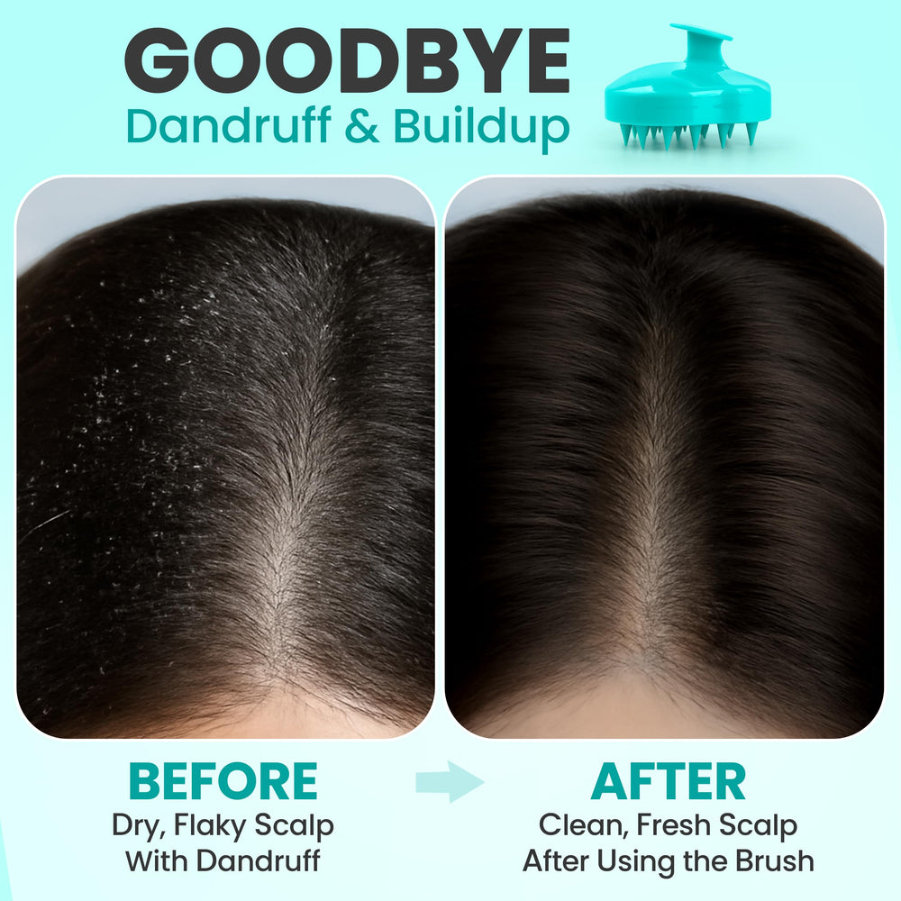 RELAXXO scalp massager exfoliation action shows deep cleansing of buildup and oil