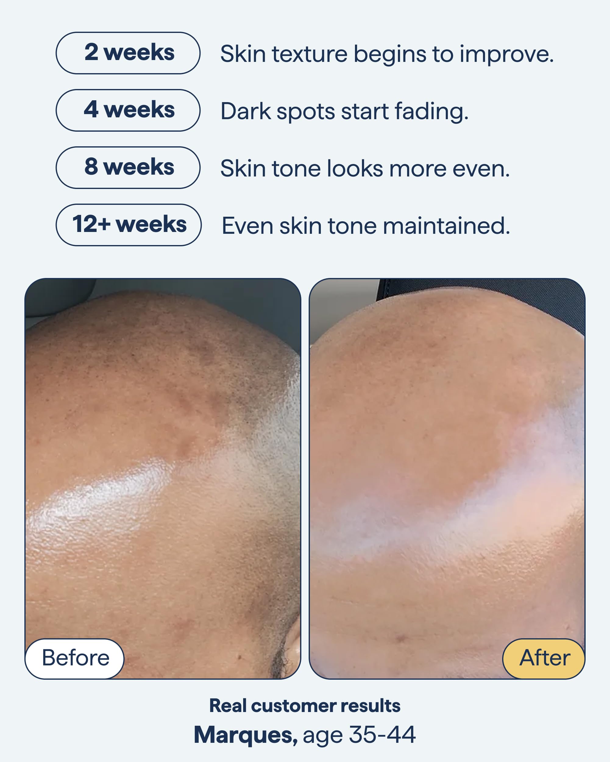 Remedy Science encapsulated-retinol close-up highlights targetting existing spots.