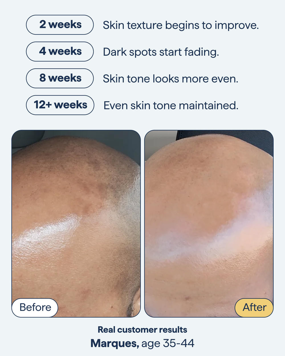 Remedy Science encapsulated-retinol close-up highlights targetting existing spots.