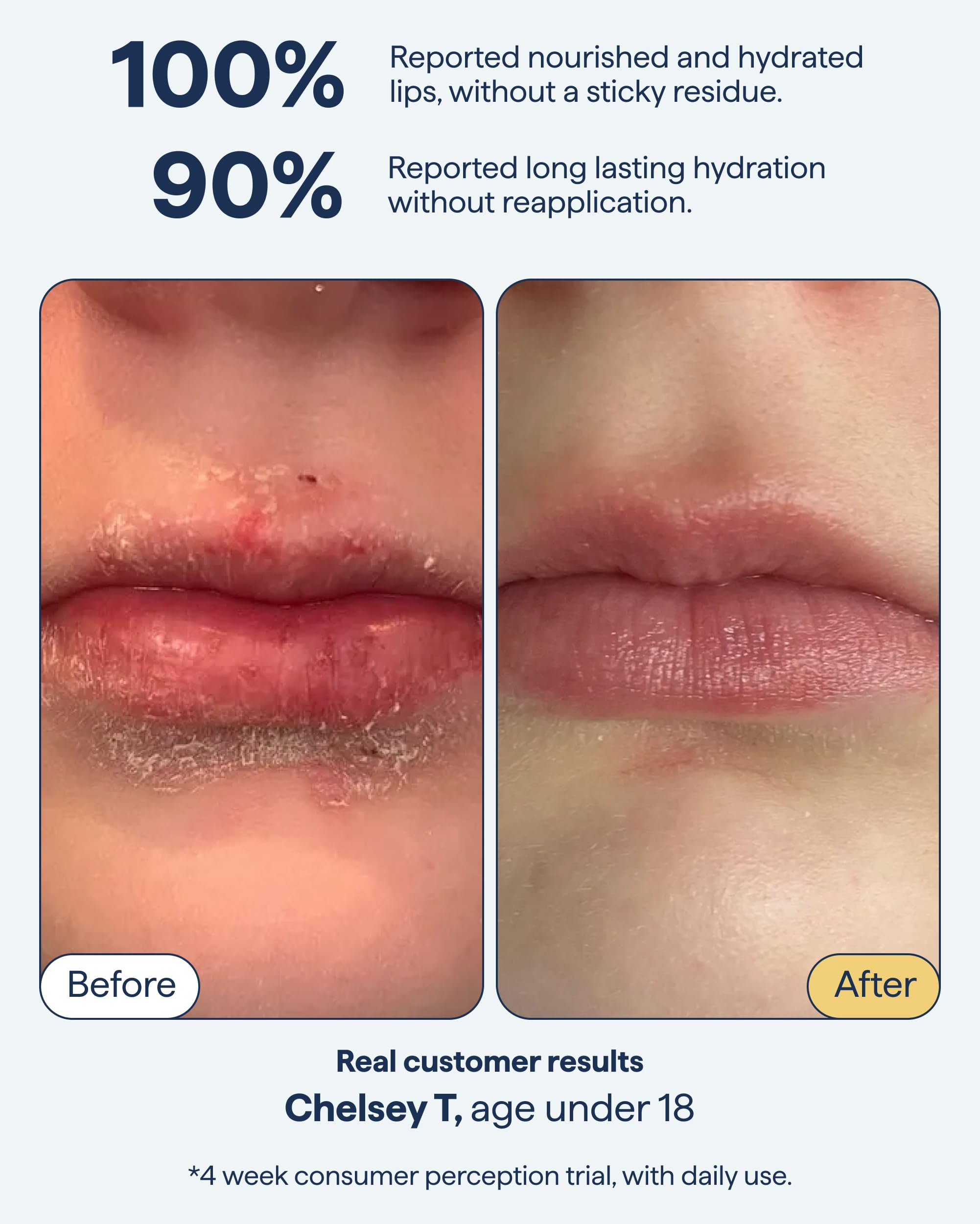 Remedy Science overnight lip-treatment scene shows soothing repair overnight