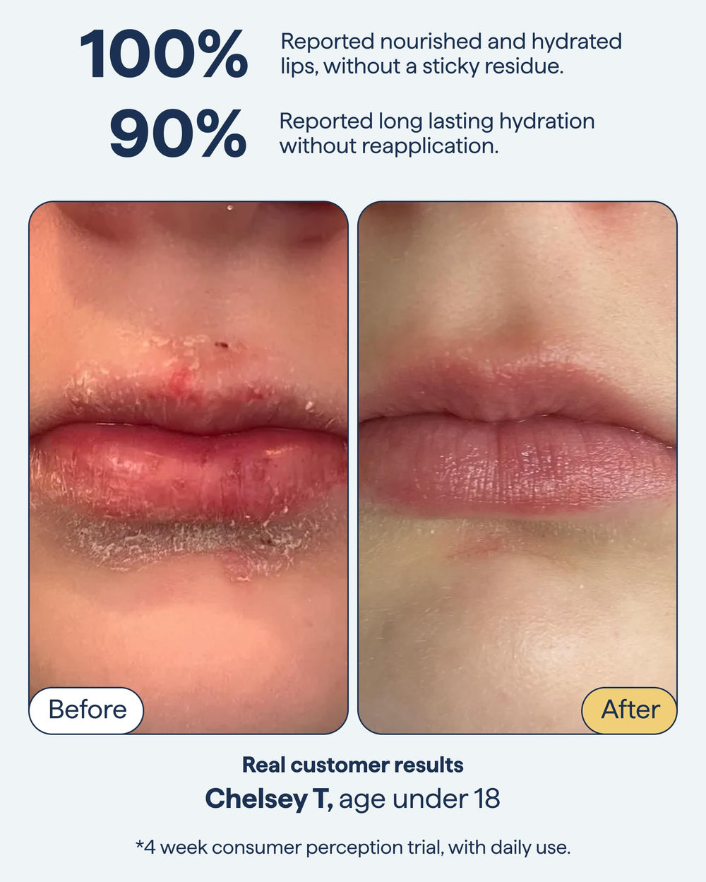 Remedy Science overnight lip-treatment scene shows soothing repair overnight