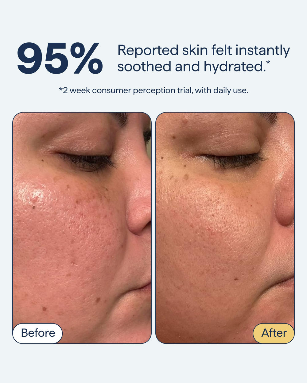 Remedy for Light Moisture ceramide-niacinamide panel highlights barrier support and oil regulation.