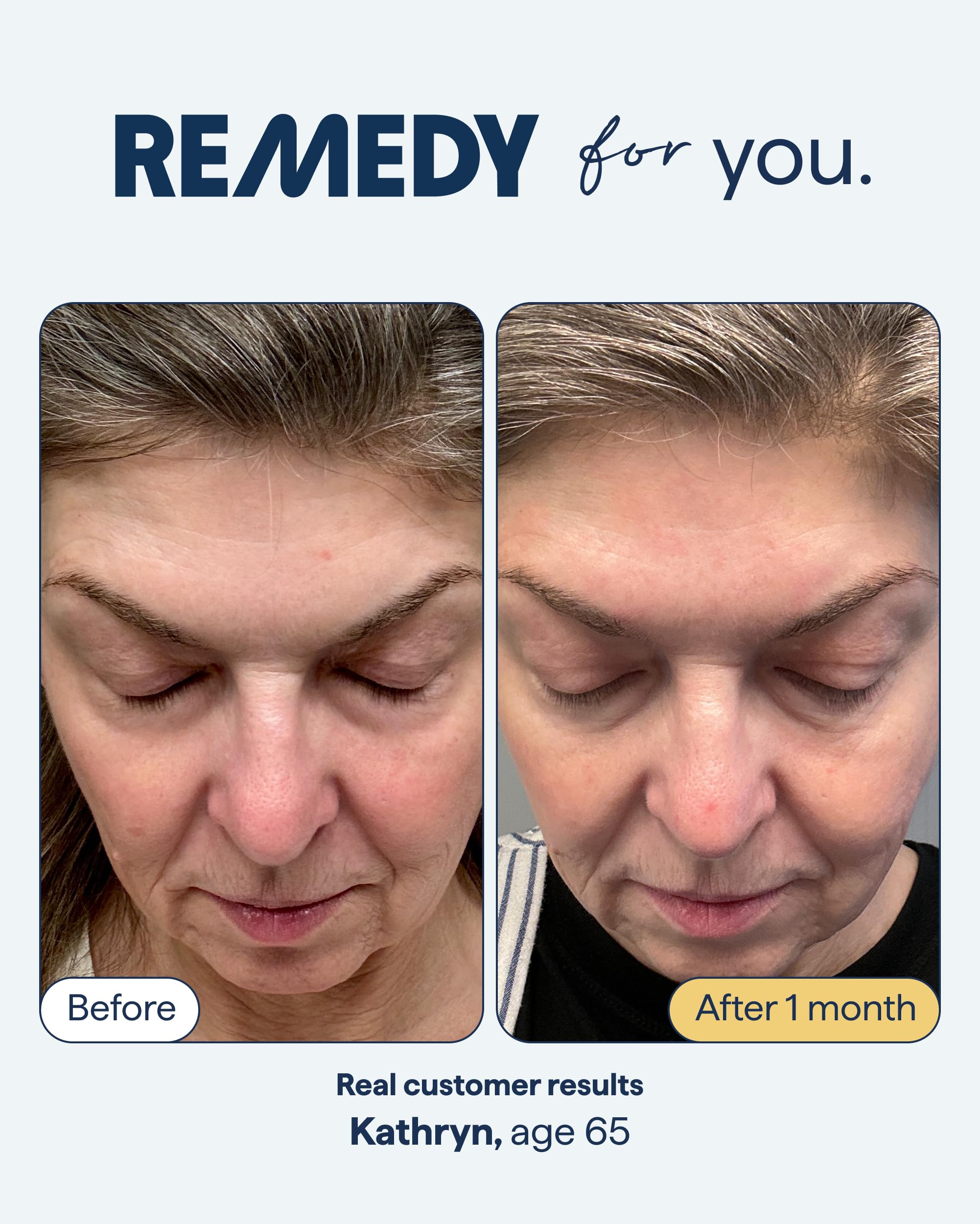 Remedy Science retinaldehyde-dropper: precise delivery supports renewed skin texture overnight