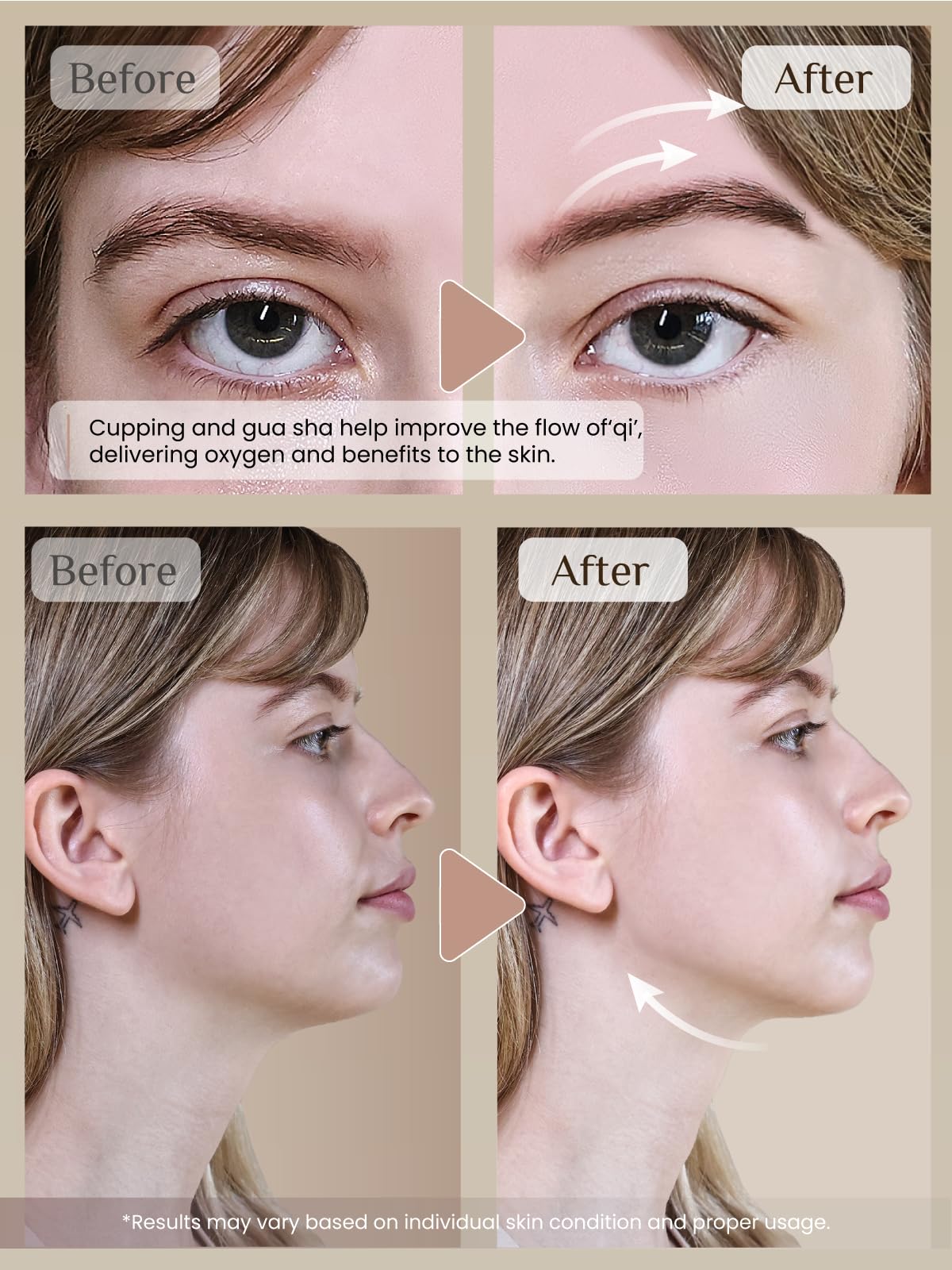 Rena Chris face cupping close-up pink silicone tool offers gentle massage and de-puffing