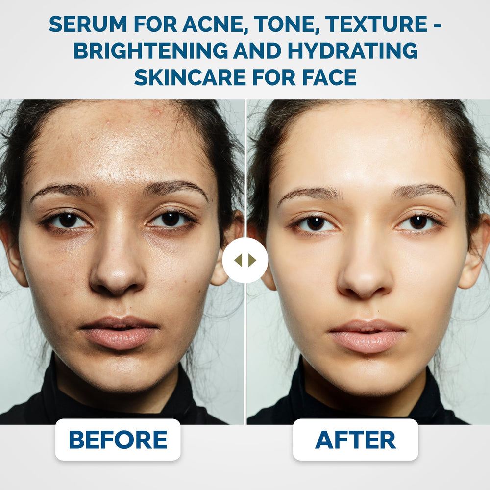 Renewa Skin AgeDefy Niacinamide 5% serum texture with fast absorption for makeup-ready skin