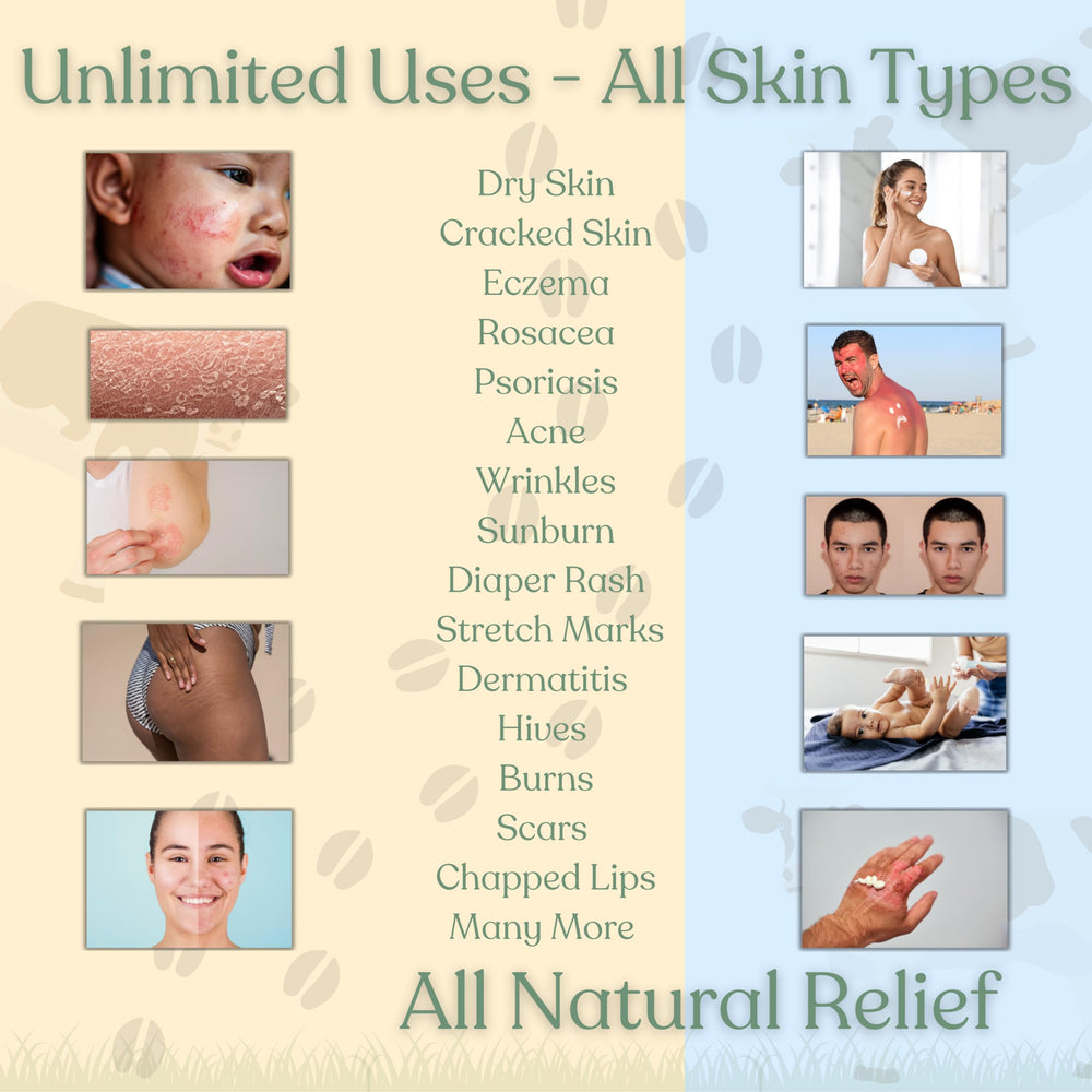 Reroot Organics Naked Tallow Balm demonstrating soothing relief for irritated skin.