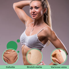 Reshape+ stretch-marks close-up illustrating smoother texture