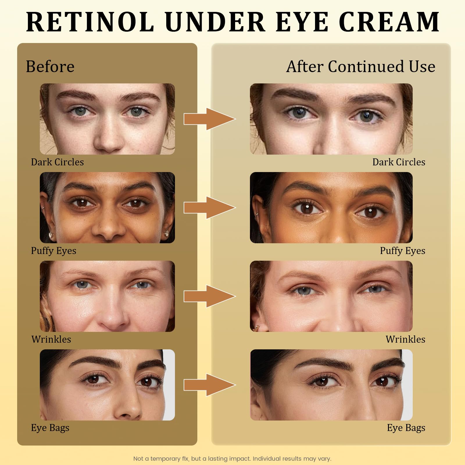 Retinol Eye Cream anti-wrinkle formula close-up emphasizing firming potential.