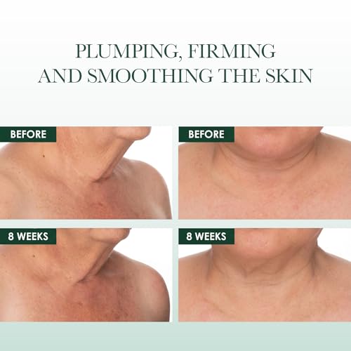 RéVive Fermitif-texture-closeup reveals creamy texture for hydration and smooth skin.