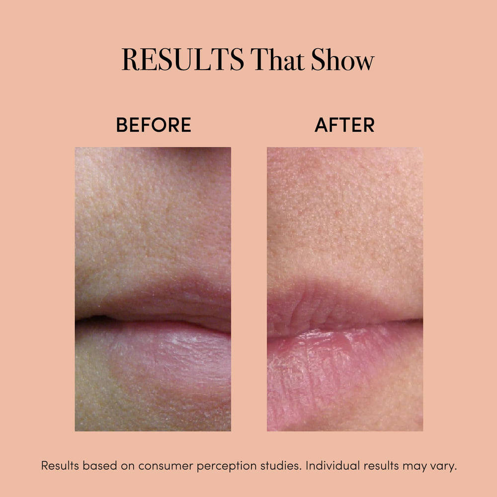 reVive Lux Therapy Light close-up emphasizes infrared and red light for lips.