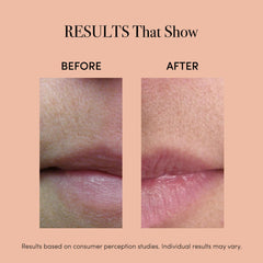 reVive Lux Therapy Light close-up emphasizes infrared and red light for lips.