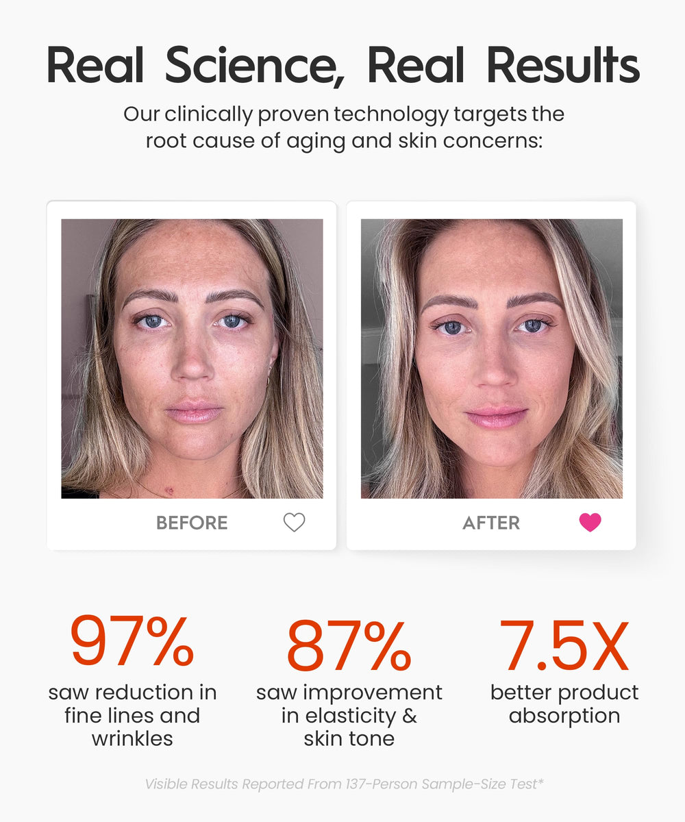 REVOMADIC REVO Genie blue light therapy for blemish-focused clarity