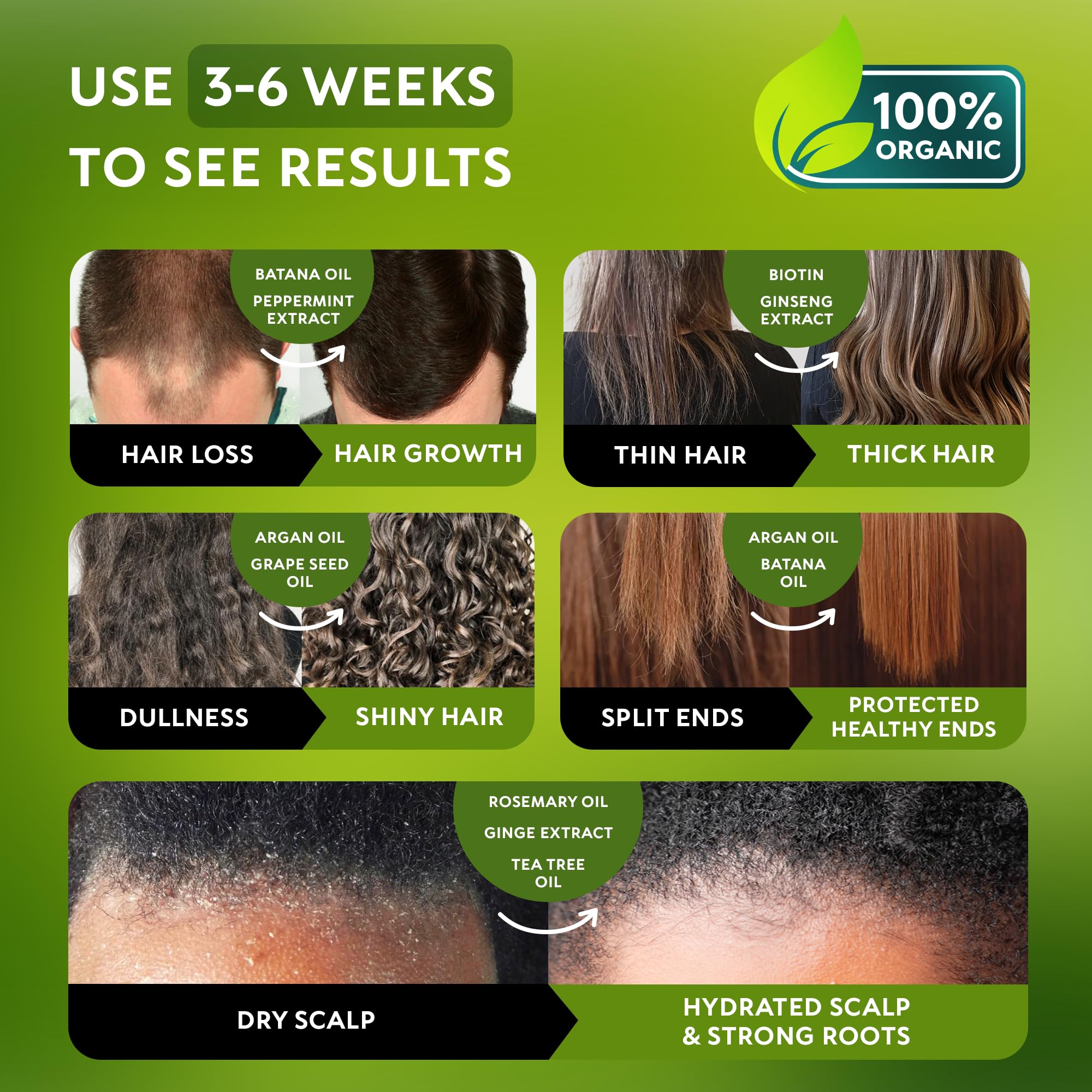 RICHGRAND Batana Oil Shampoo ingredients rosemary peppermint caffeine for scalp refresh