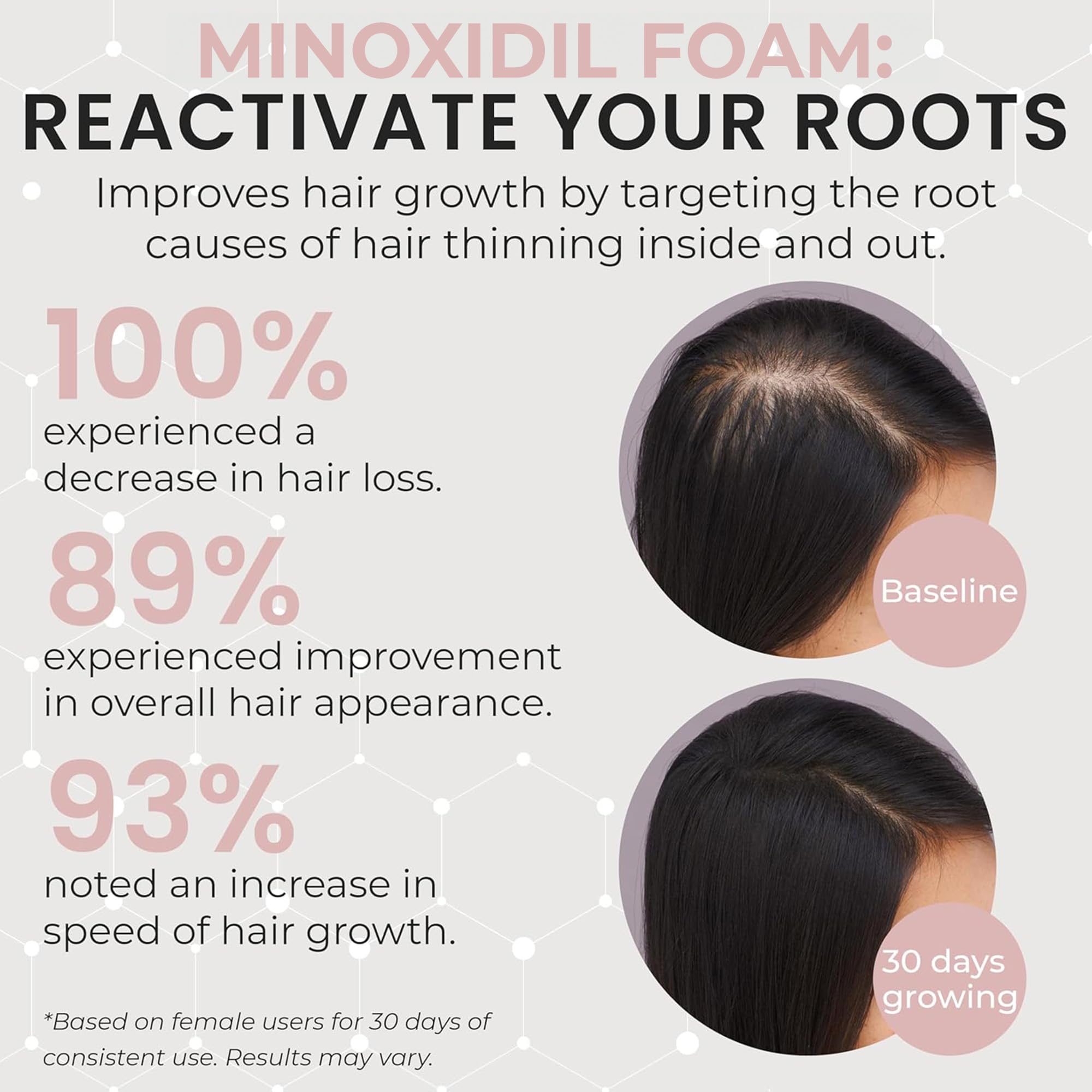 Rida Minoxidil 3-month supply packaging shows unscented, dermatologist-recommended formula.