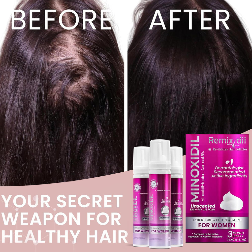 Rida Minoxidil for women demonstrates clinically proven formula for density and fullness.