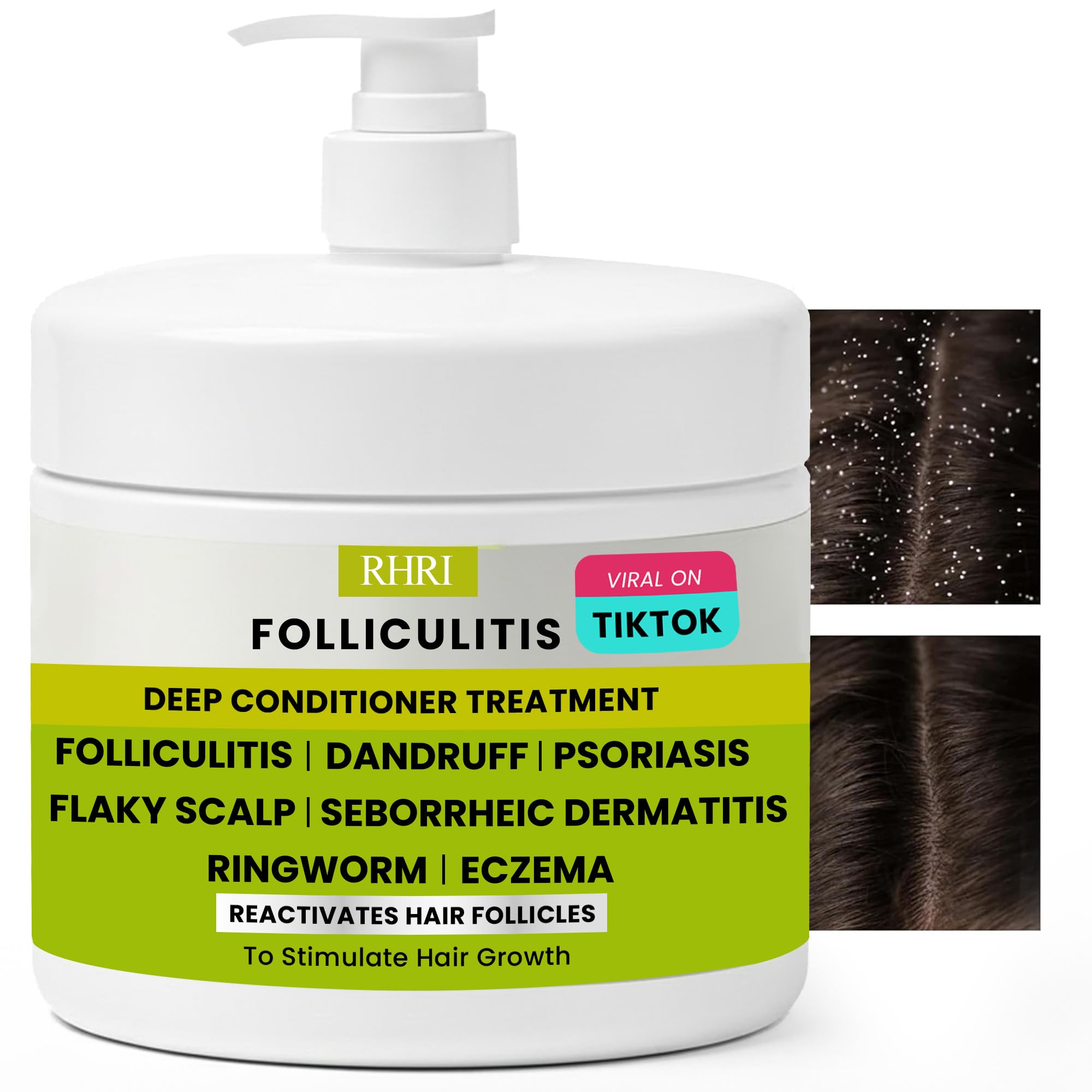 Rida Hair Research Institute Folliculitis Deep Conditioner bottle calms irritated scalp.
