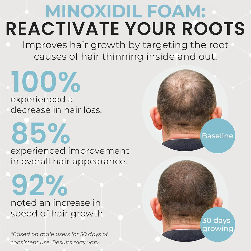 Rida Hair Remixidil before-after image suggesting density changes