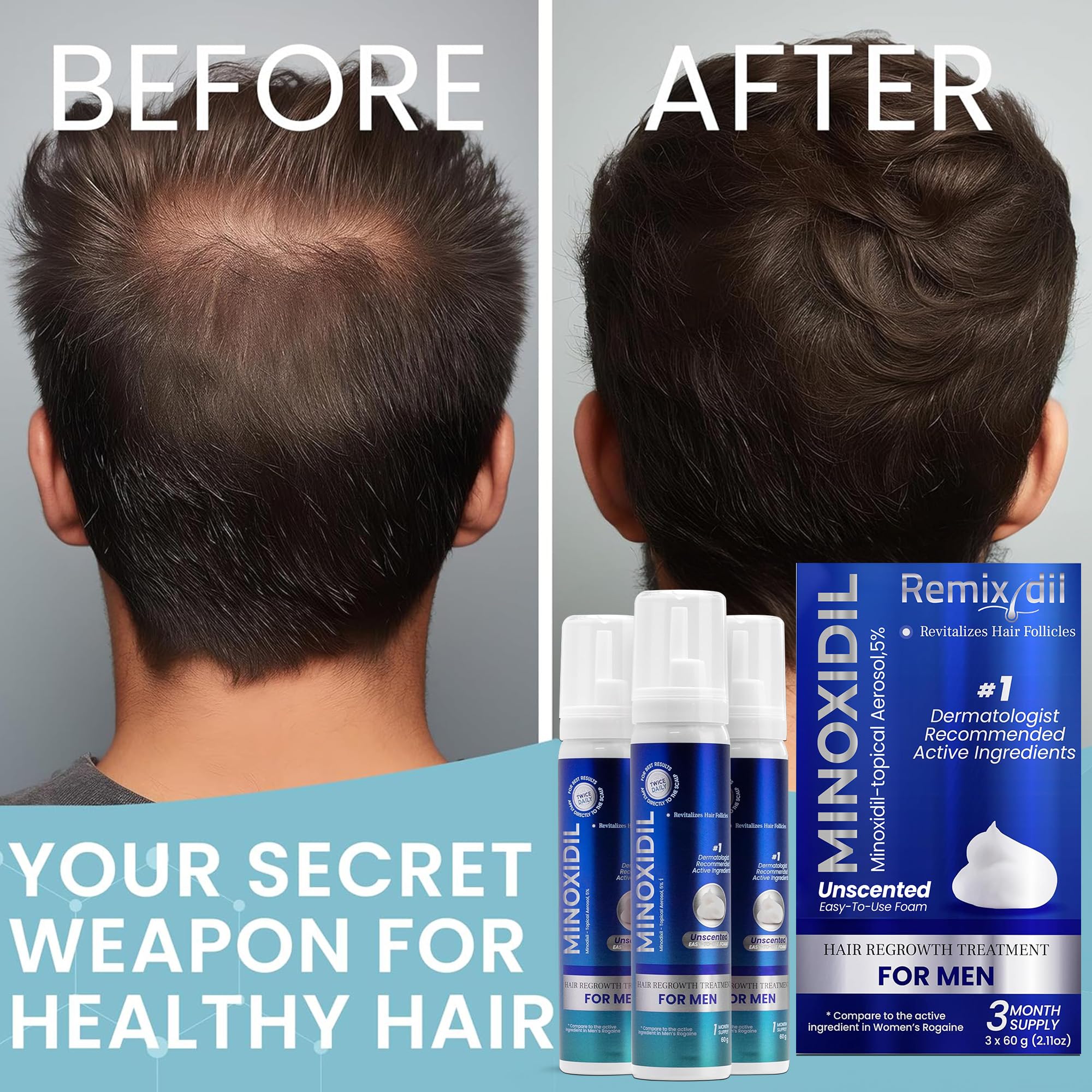 Rida Hair Remixidil ingredients list highlighting minoxidil formula