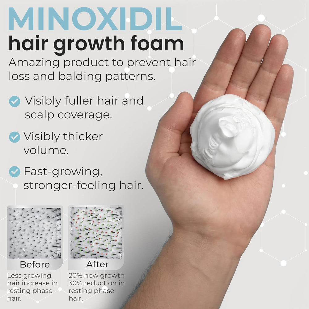 Rida Hair Remixidil packaging featuring three-month supply note